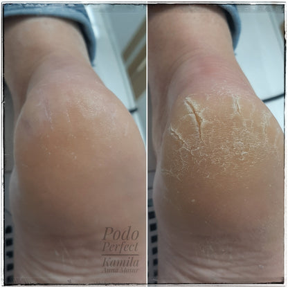 Aarkada Ointment 70 g. Regenerating hands and feet with natural collagen and essential oils