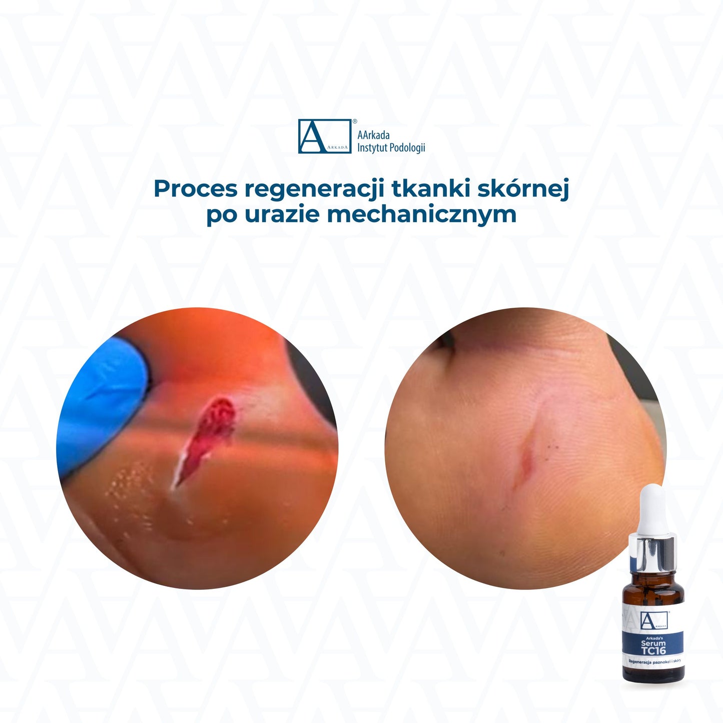 Сыворотка AArkada TC16 11 мл