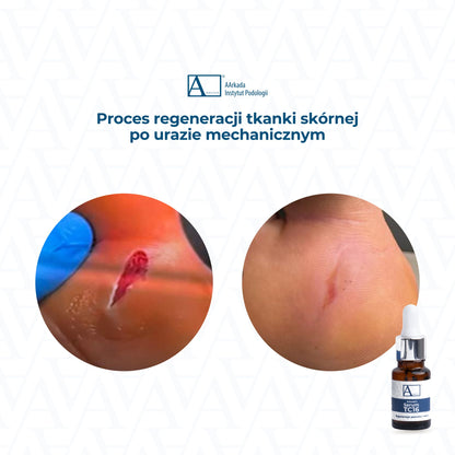 Сыворотка AArkada TC16 11 мл