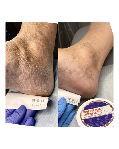 Aarkada Ointment 70 g. Regenerating hands and feet with natural collagen and essential oils