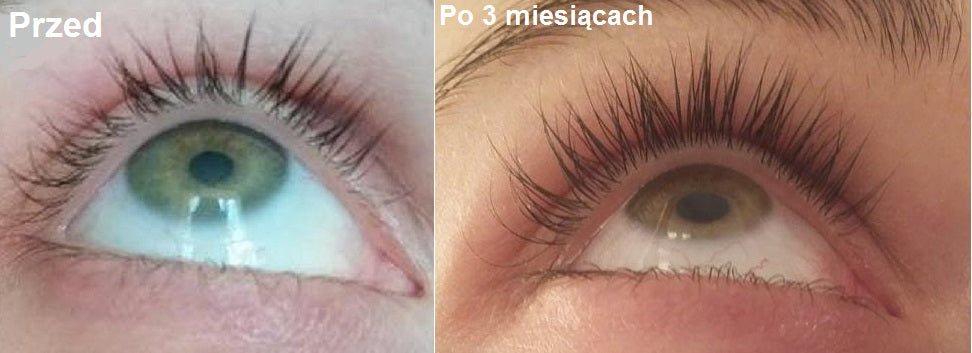 GOLD 4 Long Lashes Growth Serum for Eyelashes and Eyebrows